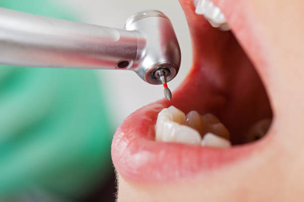 Best After-Hours Emergency Dentist in Houston, AK